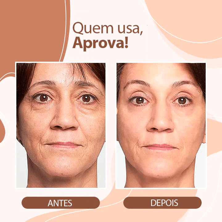 Bálsamo Derol Anti Rugas e Linhas de Expressão