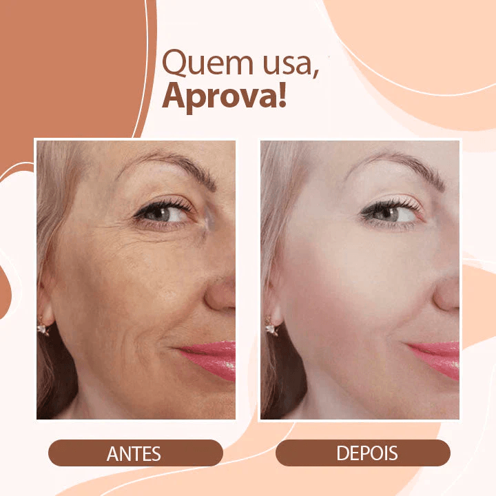 Bálsamo Derol Anti Rugas e Linhas de Expressão